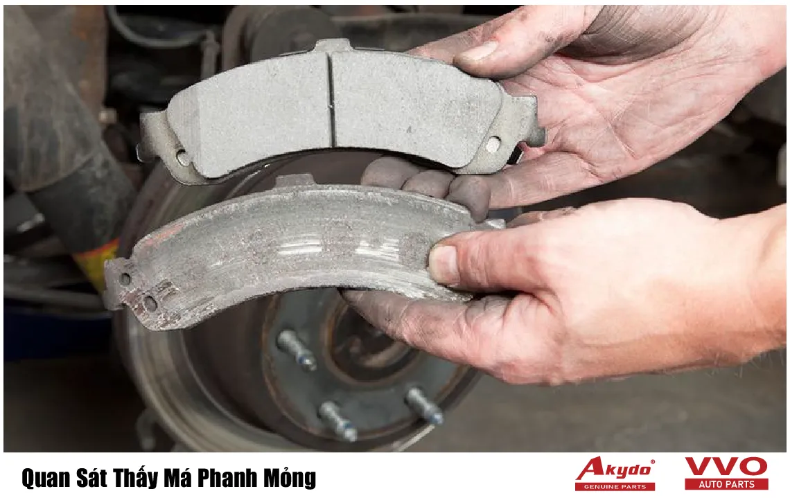 Quan Sát Thấy Má Phanh Mỏng
